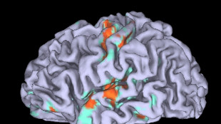 Cervello, individuato il 'motore' del sonno
