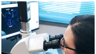 Etichette laser e IA intercettano i primi segnali dei tumori