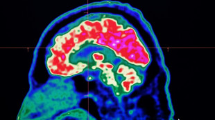 What are all these microplastics doing to our brains?