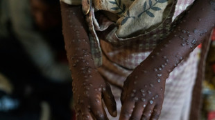 El mpox deja de ser una urgencia de salud internacional, anuncia la OMS