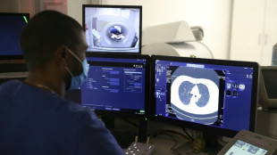 France: la lutte anti-cancer pr&ecirc;te &agrave; continuer, avec quelques angles morts