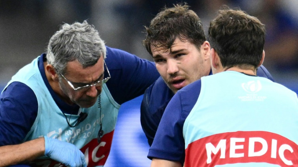 France's Dupont has facial fracture but not out of World Cup: federation